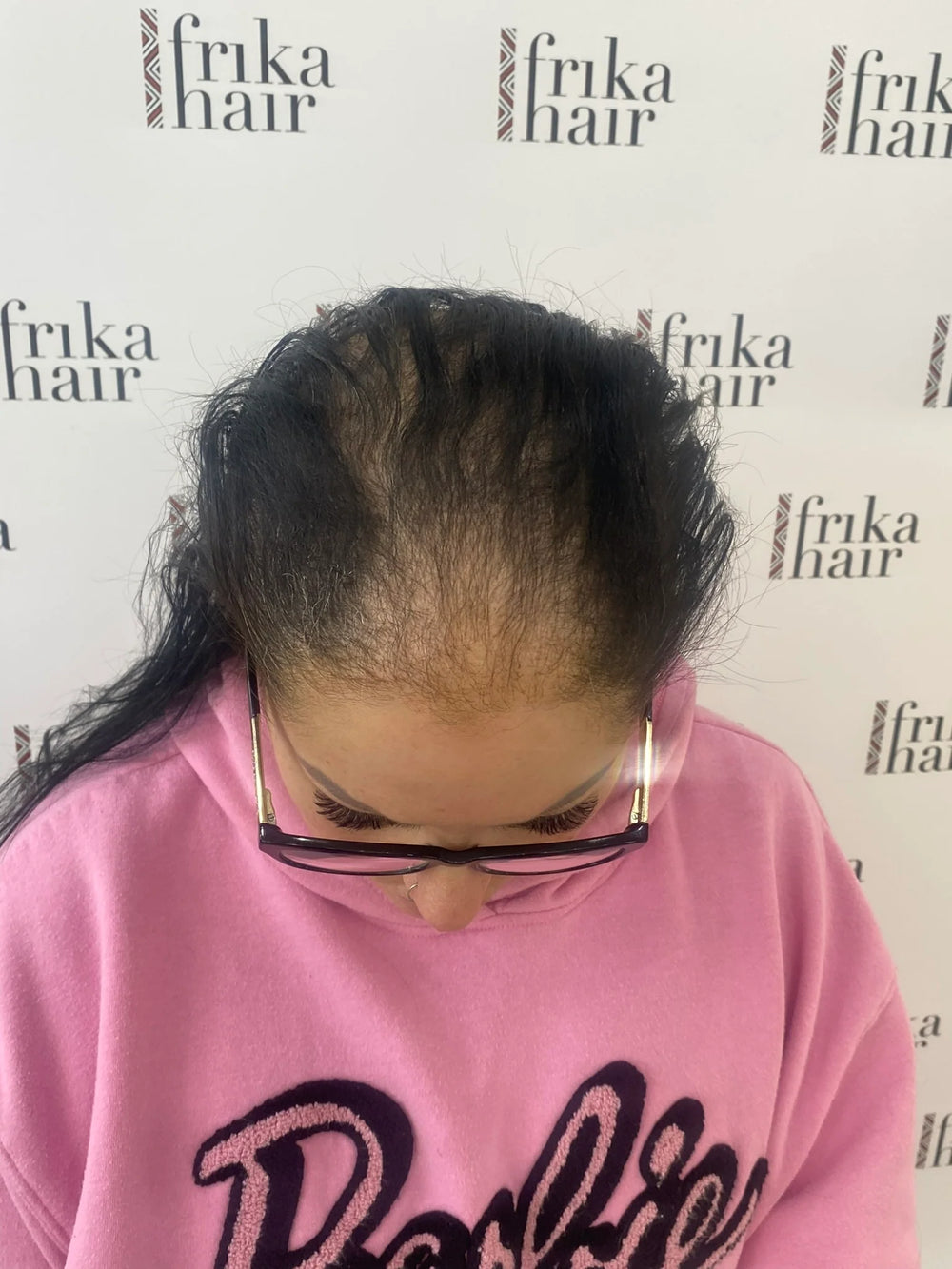 Discover the Perfect Wigs for Cancer Patients